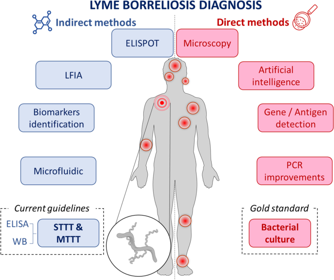 Lyme Borreliosis Dagnosis
