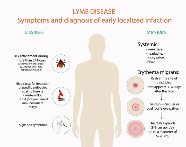 Lyme disease Diagnosis and symptoms
