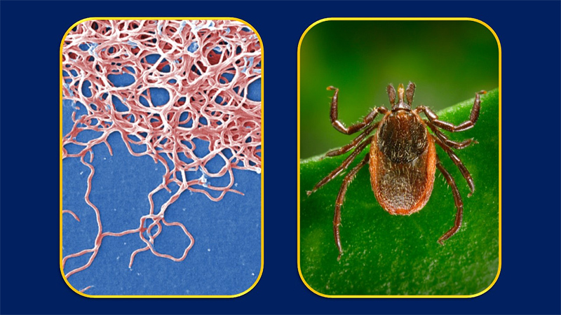 Borrelia burgdorferi bacteria