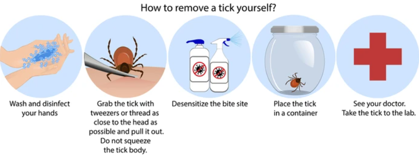 How to remove a tick yourself