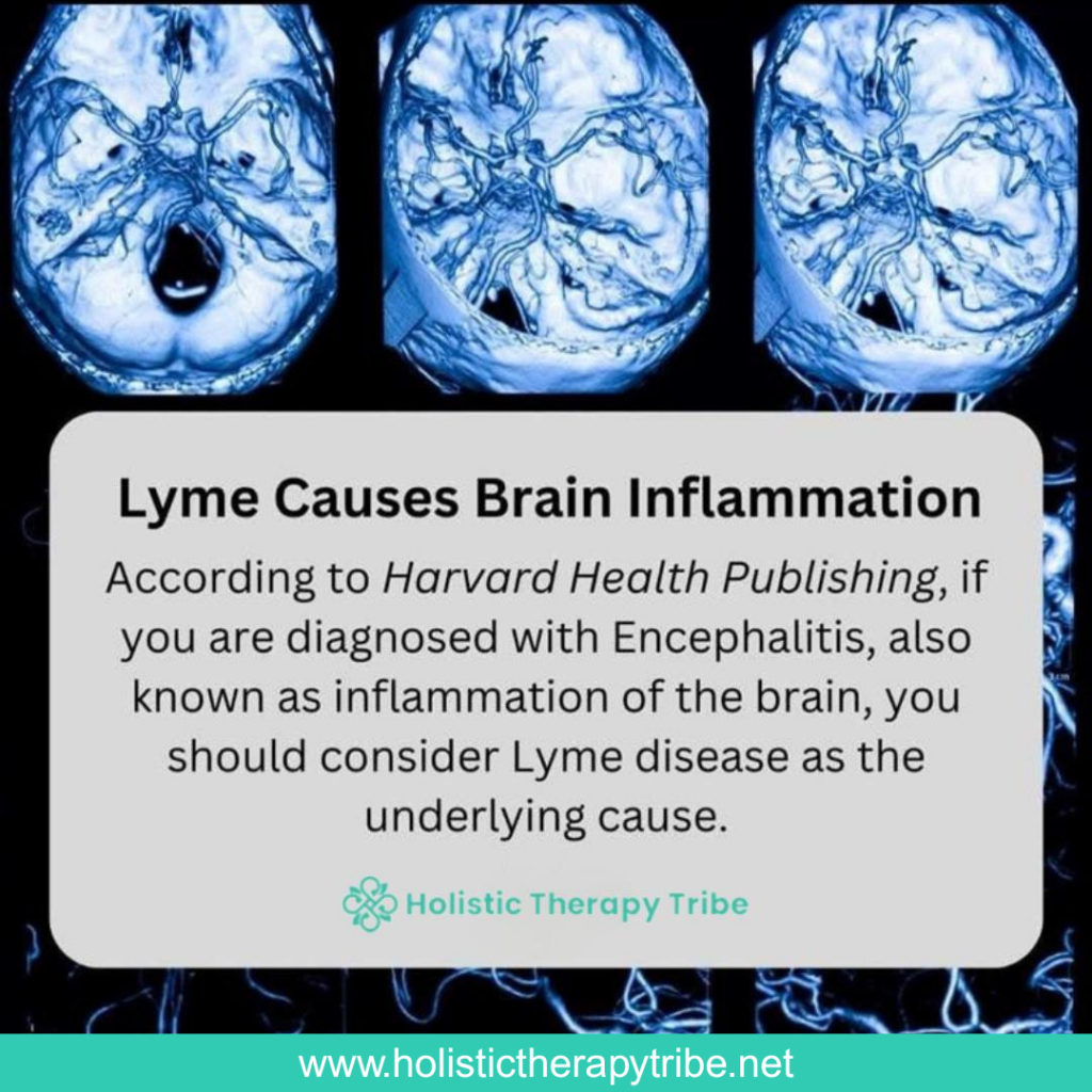 Lyme Causes Brain Inflammation