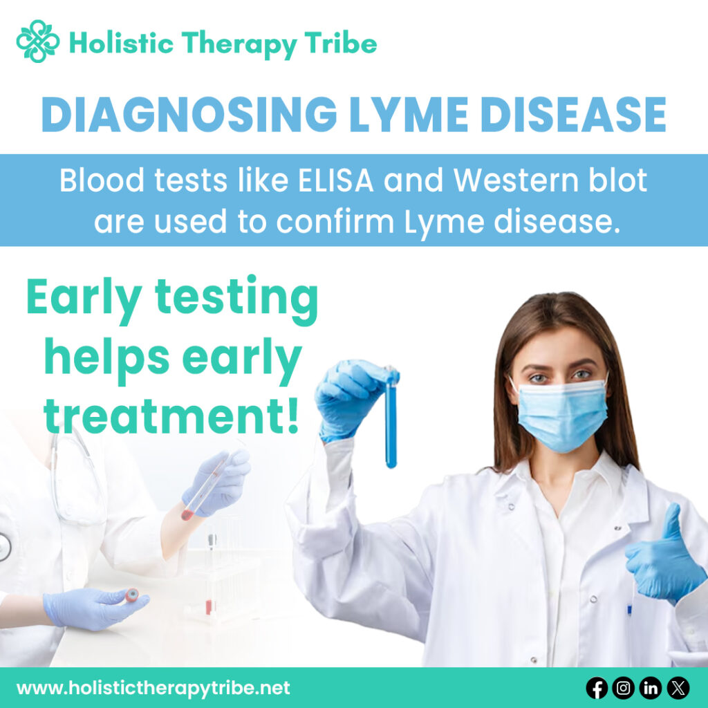 Lyme Disease Testing Techniques