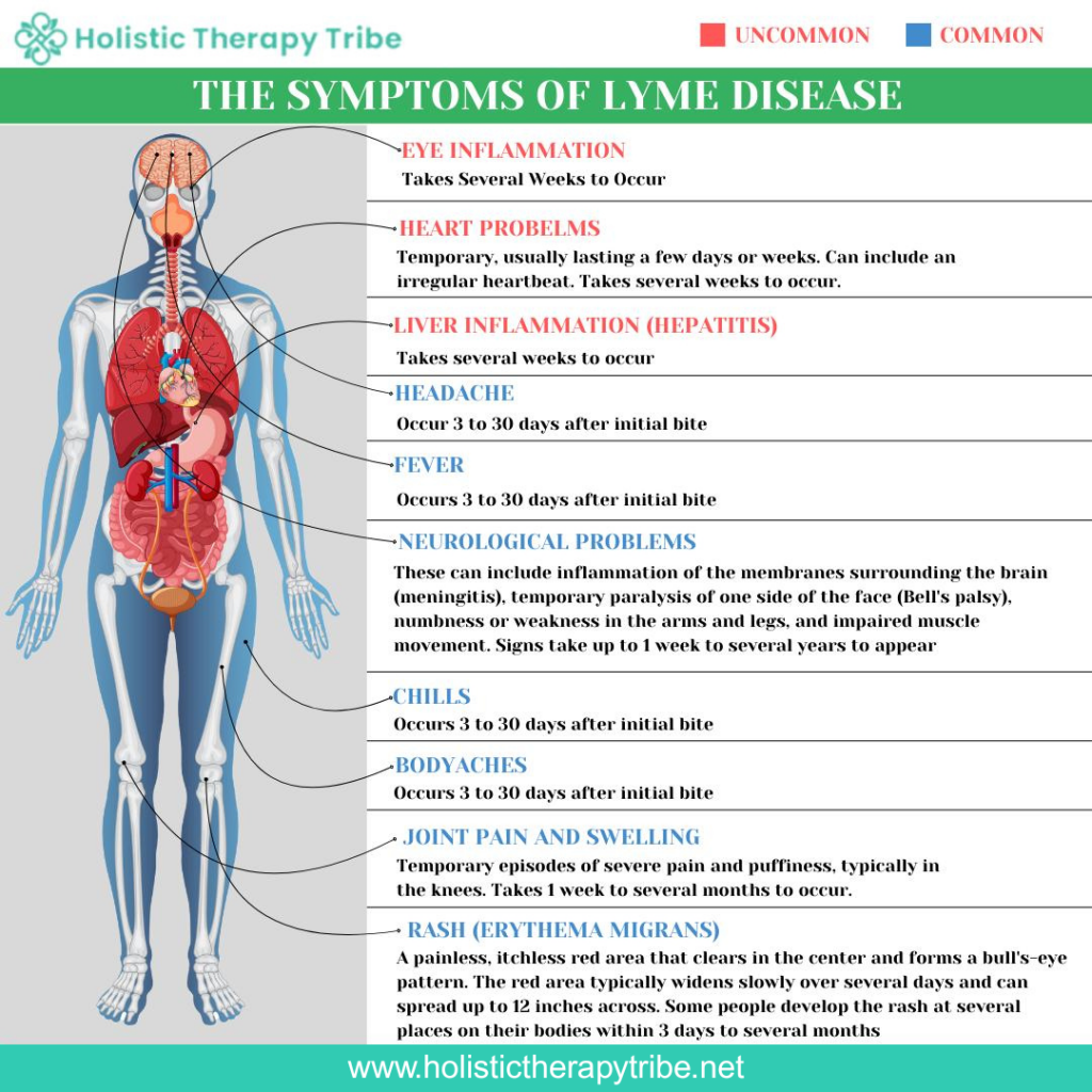 symptoms of Lyme disease after a tick bite