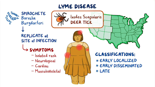 Tick transmitting Lyme disease bacteria through a bite to human skin