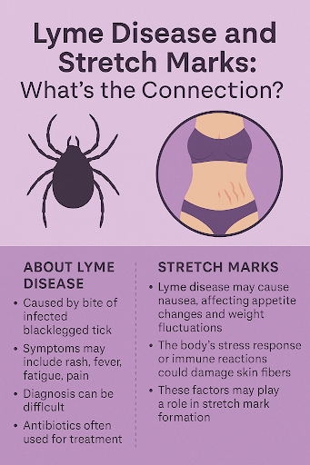 Lyme disease skin changes and stretch mark-like rash symptoms