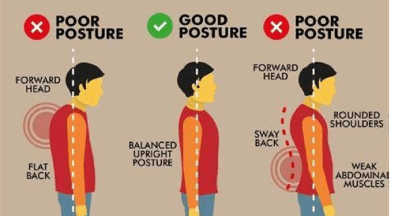Poor Posture and Back Pain