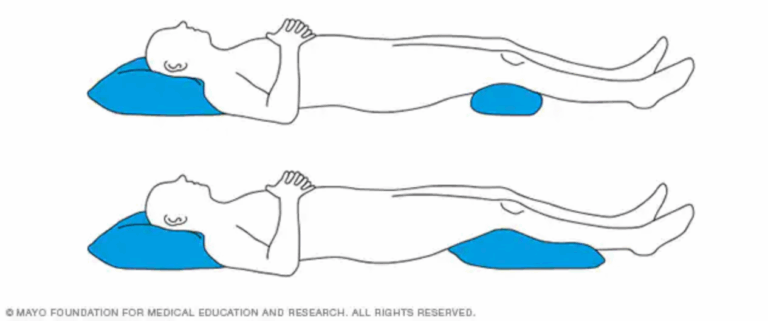 Sleeping Back Pain – Best Positions & Tips