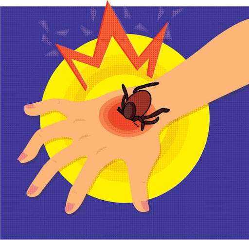 Can Chiggers, Bed Bugs, or Spiders Give You Lyme Disease? Here’s the Truth