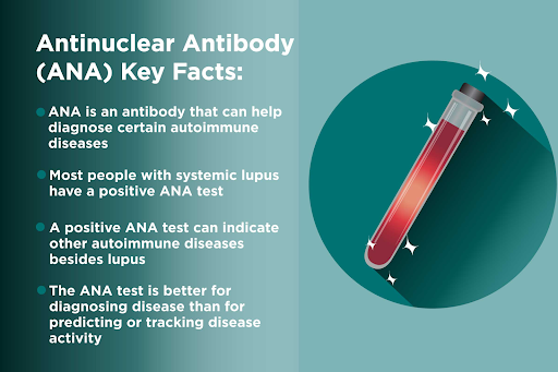 antinuclear-antibody-key-facts