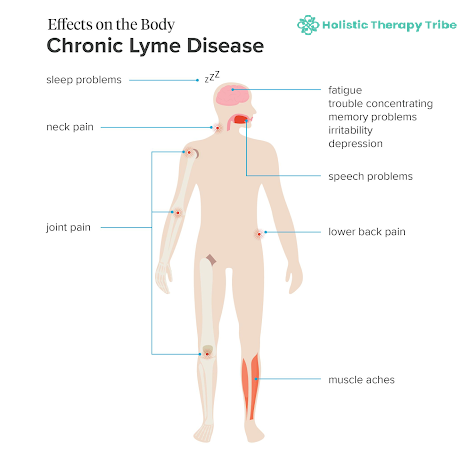 chronic-lyme-disease