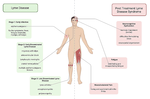 chronic-lyme-disease-symptoms