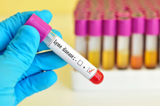 Lyme disease diagnosis infographic showing medical testing, symptom evaluation, and tick exposure assessment