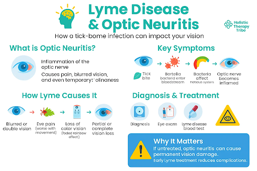 Optic neuritis symptoms and Lyme disease awareness illustration