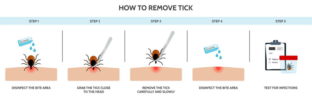tick-bite-steps