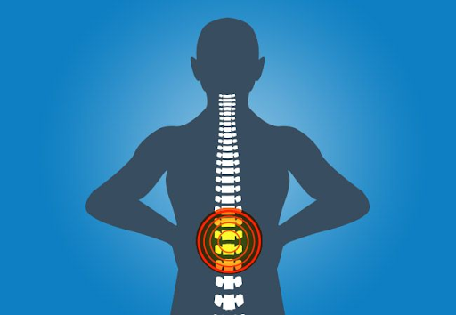 Spinal Tap and Degeneration in Lyme Disease Explained