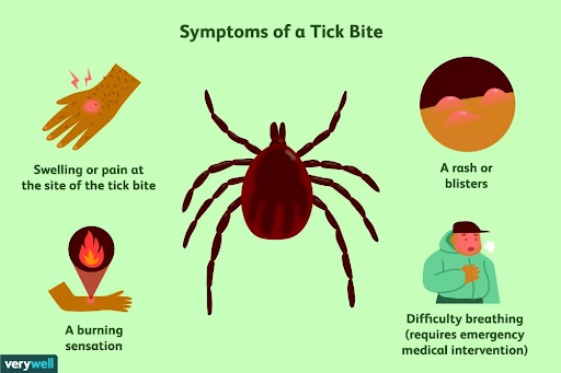 Comparison of Lyme disease and Rocky Mountain spotted fever symptoms and rashes