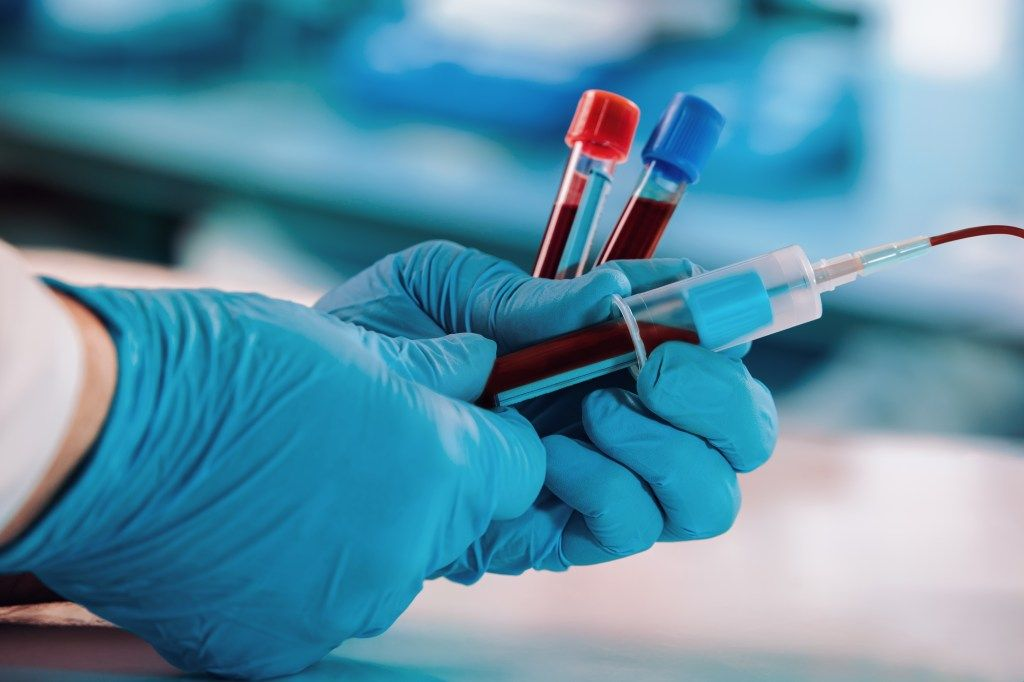 Lyme disease serology blood test for detecting Borrelia antibodies